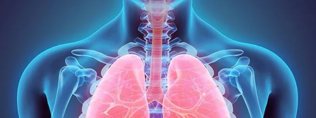asthma-s1