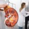 Early Signs of Kidney Disease You Should Never Ignore